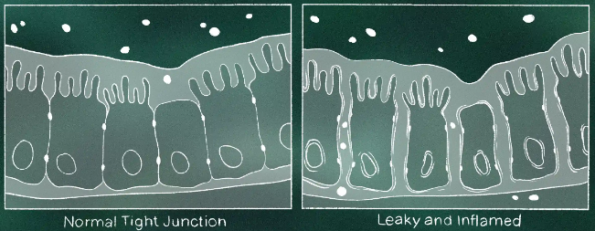 Leaky Gut Inflammation Animation